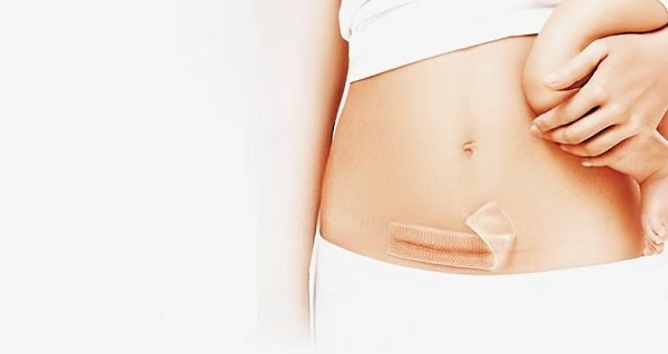 Miks on paksud silikoongeelist armikatted nii populaarsed?